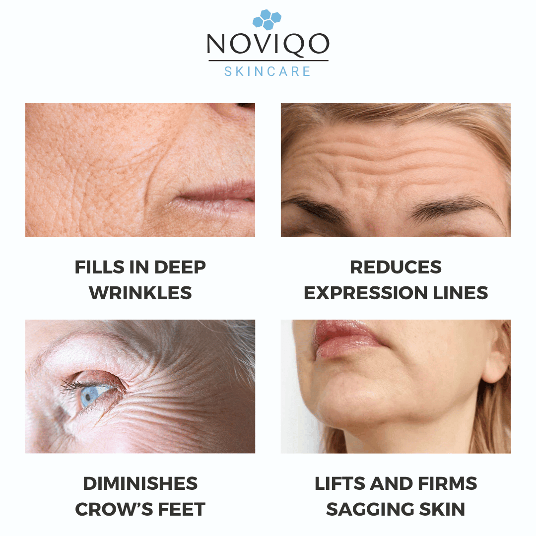 Noviqo™ – Anti-Wrinkle Nano-Silk Collagen Renewal System